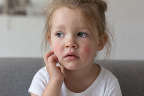 Peaux sensibles chez les enfants : spécificités et conseils adaptés