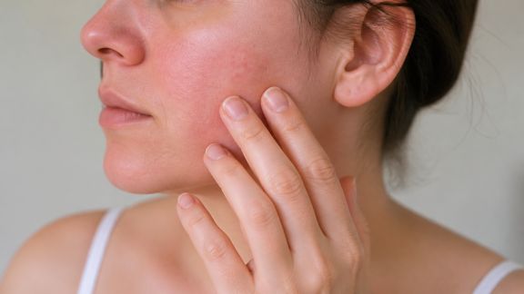 Distinguer sensibilité et allergies cutanées : comment faire la différence ?