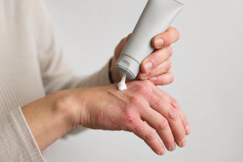 Crèmes pour les mains abîmées : test de solutions ciblées