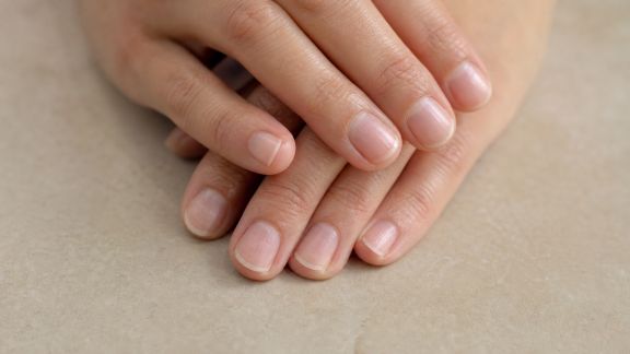 Solutions pour ongles mous : résultats après un mois d’utilisation