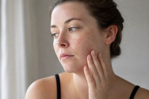 Préparer sa peau sensible aux changements de saison : conseils pratiques