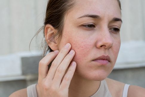 Comment le climat influence la sensibilité de votre peau