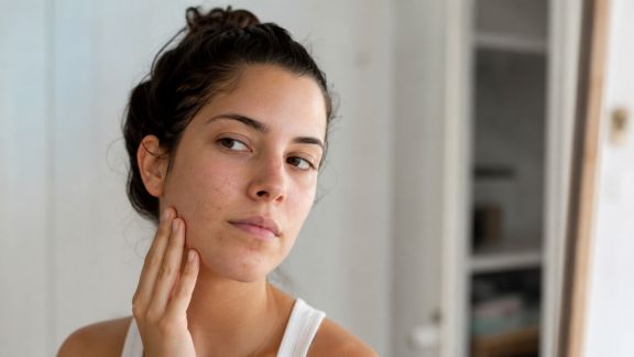 Comment gérer les imperfections sans agresser sa peau