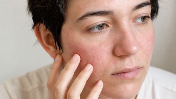 Allergies cutanées : comment identifier et apaiser les réactions du visage