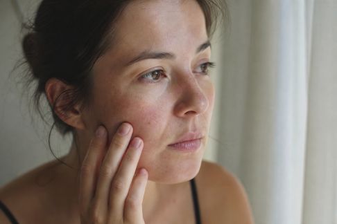 Comment préparer sa peau sensible avant un changement de climat ?